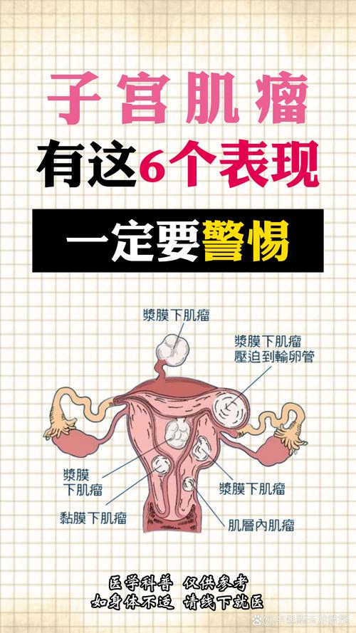 子宫肉瘤早期有哪些表现