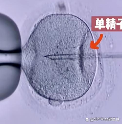 精子碎片率多少建议做二代试管