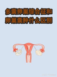 多囊卵巢和卵巢囊肿一样吗-两性知识丨两性健康--你想了解的我都知道