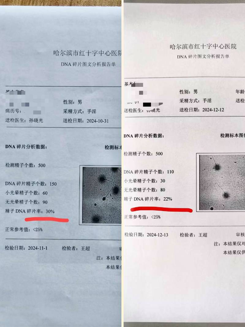 精子DNA碎片率怎么检查