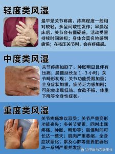 性欲低和类风湿关节炎有关吗?-两性知识丨两性健康--你想了解的我都知道