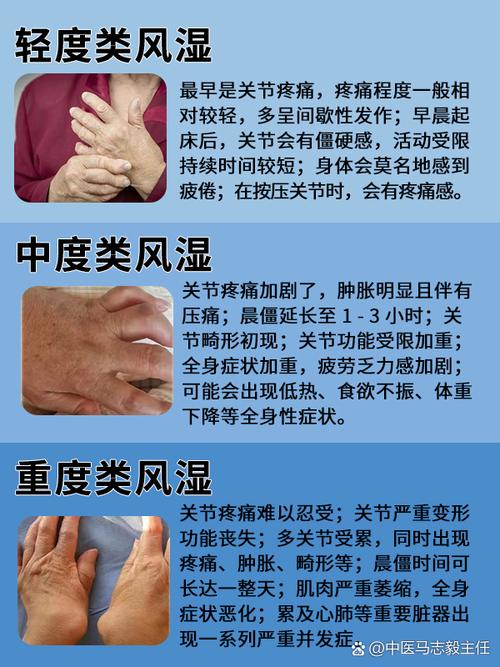 性欲低和类风湿关节炎有关吗