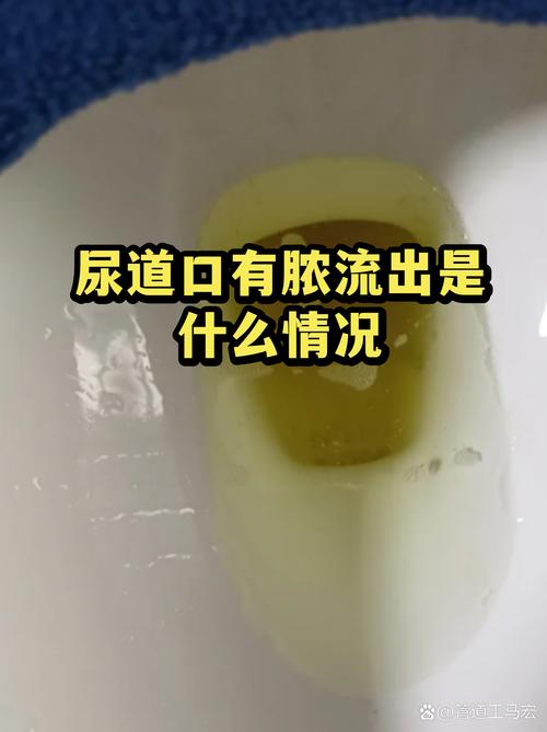 尿道口流脓，可能是什么病
