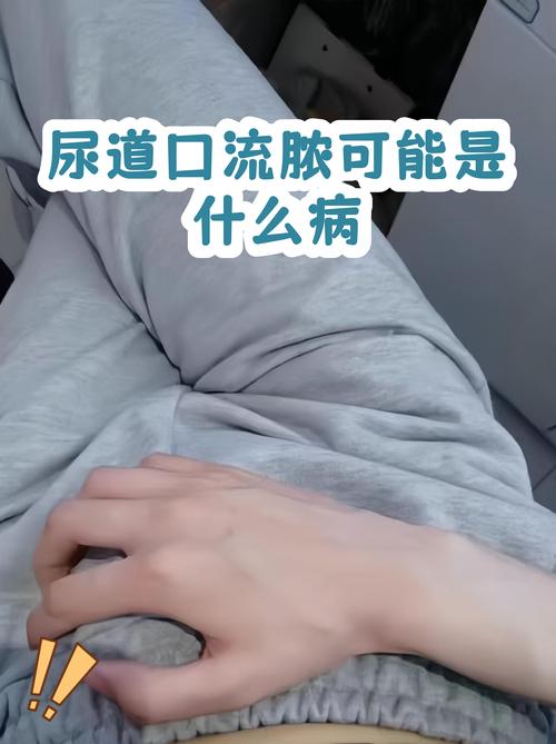 尿道口流脓，可能是什么病