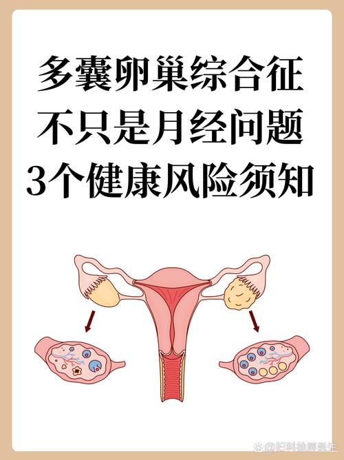 多囊卵巢会导致性欲低吗