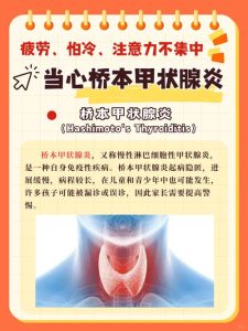 桥本甲状腺炎会让性欲变差吗?-两性知识丨两性健康--你想了解的我都知道