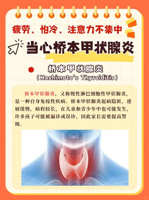 桥本甲状腺炎会导致性欲低吗