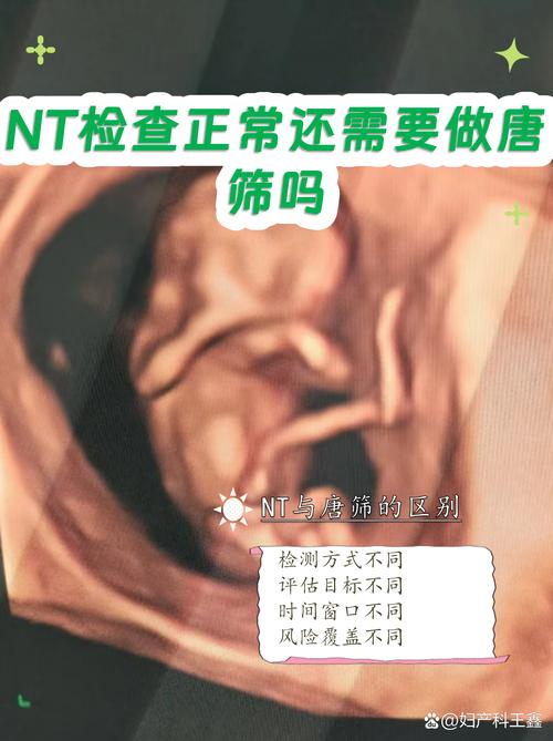 NT检查和唐筛有什么区别
