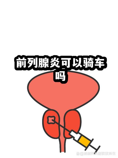 前列腺炎患者能骑车锻炼吗