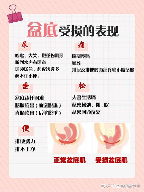 二胎后盆底损伤会更严重吗
