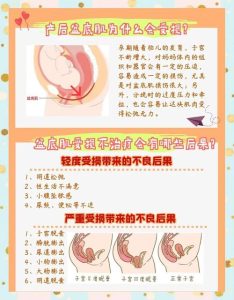 二胎后盆底损伤真的会比头胎更严重吗?-两性知识丨两性健康--你想了解的我都知道