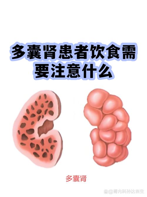 多囊患者饮食要注意什么