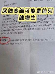 尿线变细或尿等待,是增生信号吗?-两性知识丨两性健康--你想了解的我都知道