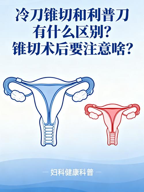 宫颈冷刀锥切和LEEP区别