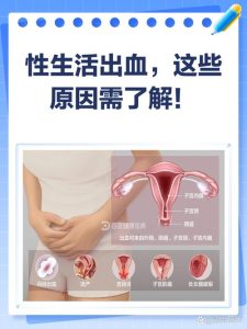 宫颈病变治疗后同房出血怎么办-两性知识丨两性健康--你想了解的我都知道