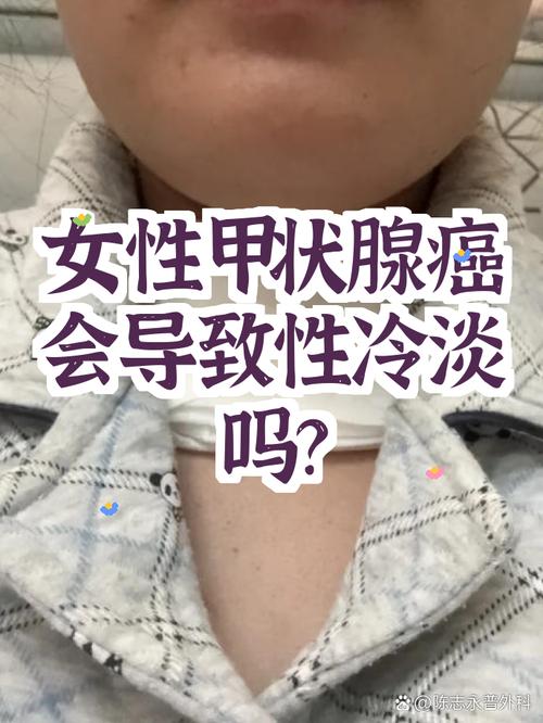 性欲低和甲状腺癌术后有关吗