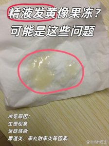 精液发黄、呈果冻状，这是正常还是异常？-两性知识丨两性健康--你想了解的我都知道