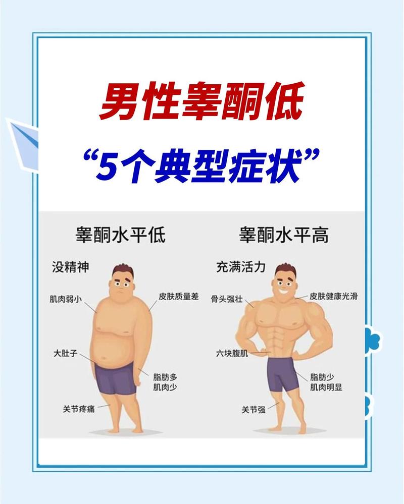 睾酮偏低有哪些表现，该怎么查