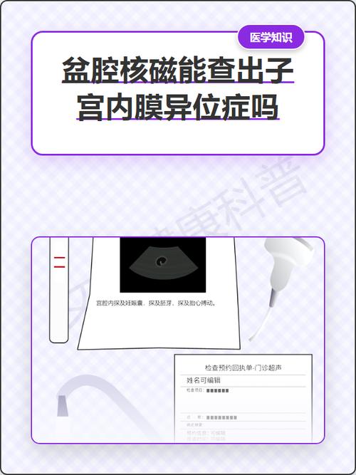 内异症要做核磁共振吗