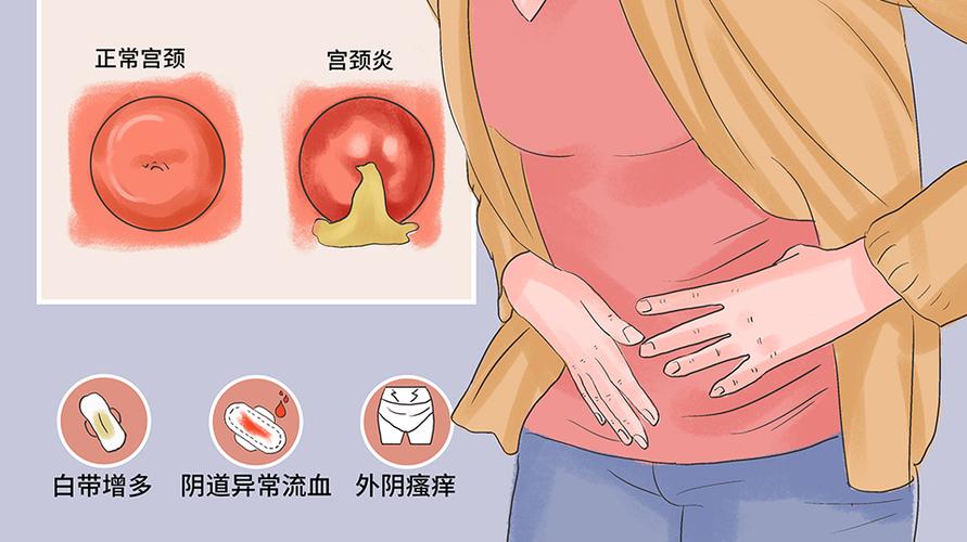 阴道炎反复和伴侣有关吗