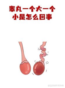 睾丸一大一小差别明显,要紧吗?-两性知识丨两性健康--你想了解的我都知道