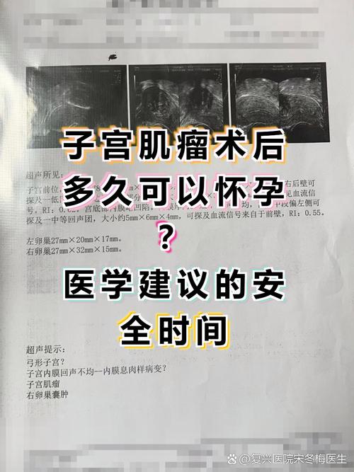 子宫肌瘤剔除后多久能怀孕