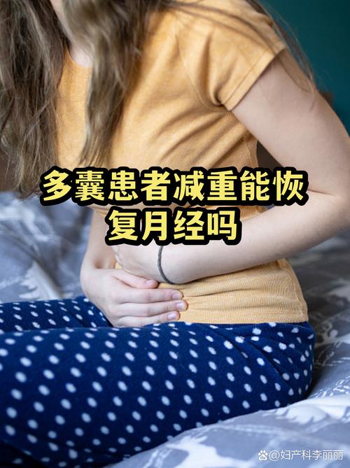 多囊患者促排卵前要减重吗