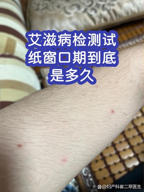 艾滋病窗口期检测能查出什么
