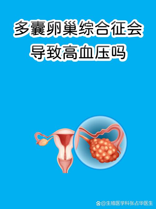 多囊和高血压有关吗