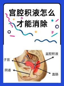 盆腔积液多深才需要进一步查-两性知识丨两性健康--你想了解的我都知道