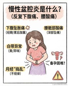 盆腔炎真的会引起长期腰酸吗?该怎么缓解-两性知识丨两性健康--你想了解的我都知道