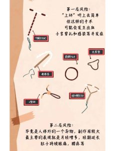 避孕环到期不取的风险，比很多人预想中更实在-两性知识丨两性健康--你想了解的我都知道