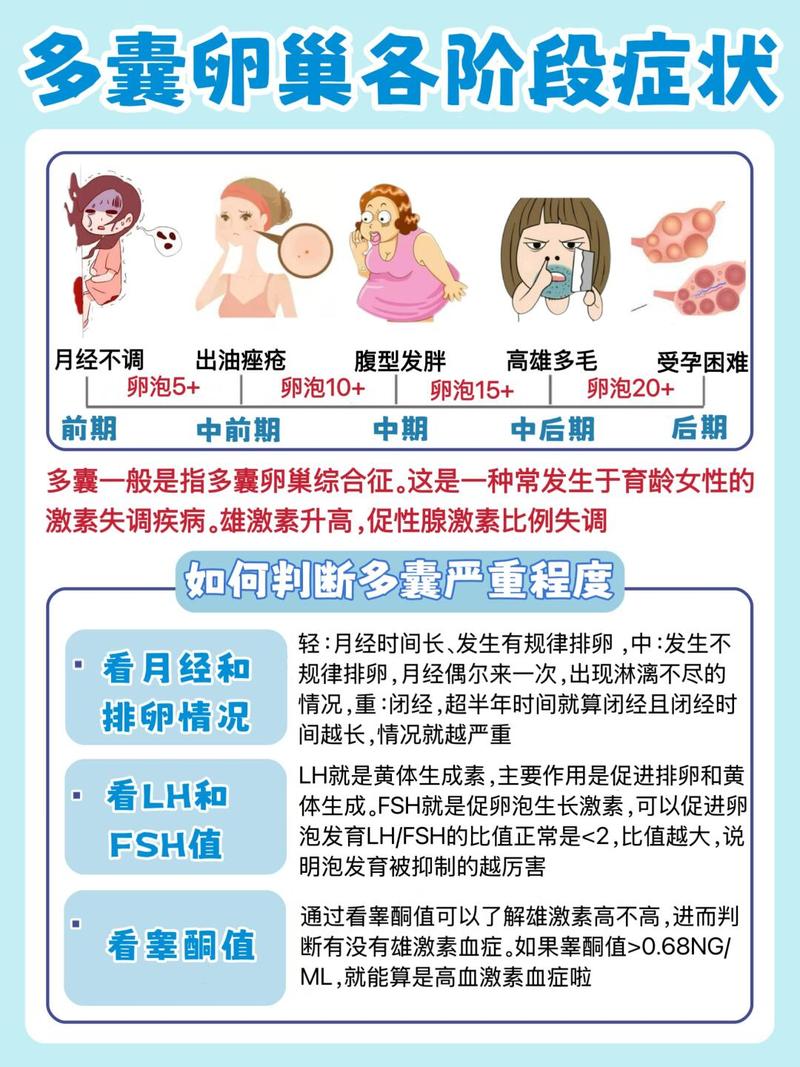 多囊卵巢综合征怎么确诊