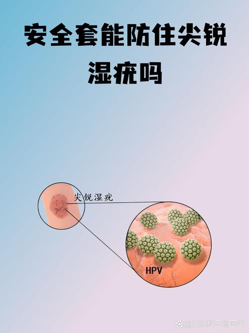 同房用安全套能挡住HPV吗