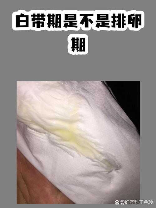 白带变多是排卵期到了吗