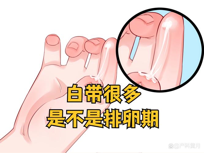 白带变多是排卵期到了吗
