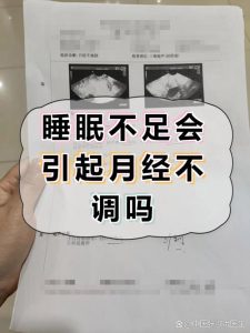 睡眠不足和月经紊乱有关联吗-两性知识丨两性健康--你想了解的我都知道