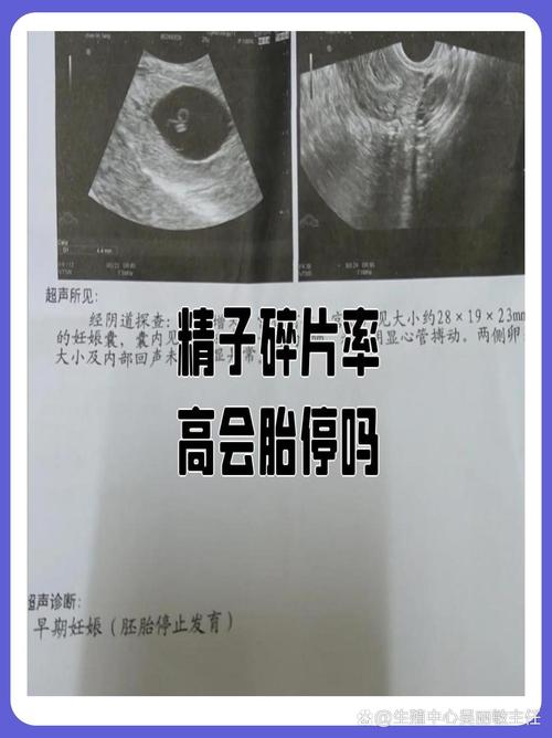 碎片率高会影响胚胎质量吗