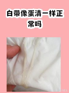 白带拉丝像蛋清,多半是身体在报排卵期-两性知识丨两性健康--你想了解的我都知道