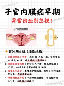 哪些异常出血要警惕妇科肿瘤-两性知识丨两性健康--你想了解的我都知道