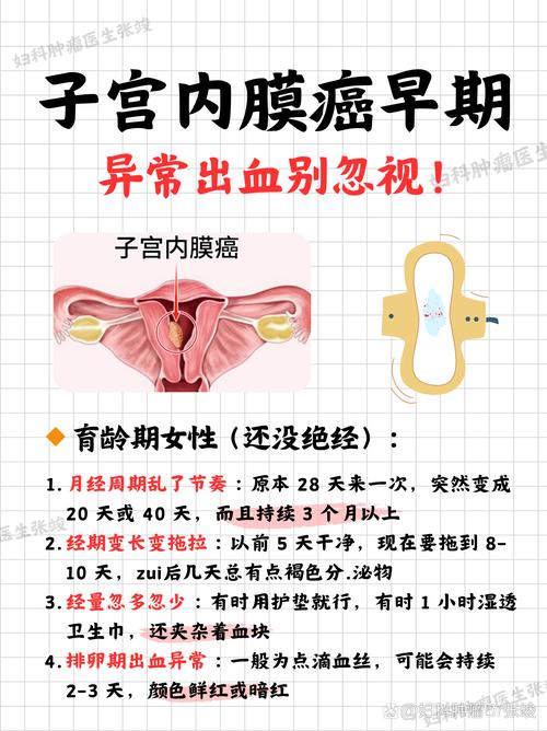哪些异常出血要警惕妇科肿瘤