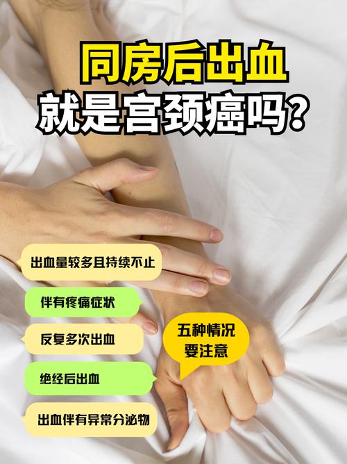 哪些异常出血要警惕妇科肿瘤