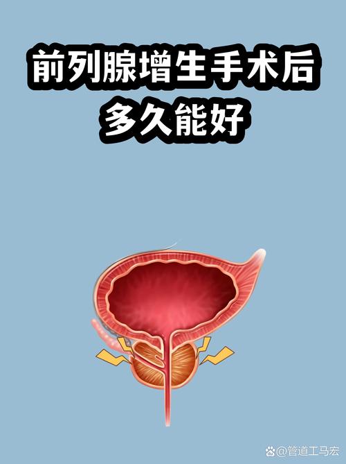 前列腺增生什么时候考虑手术
