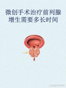 前列腺增生什么时候考虑手术?-两性知识丨两性健康--你想了解的我都知道