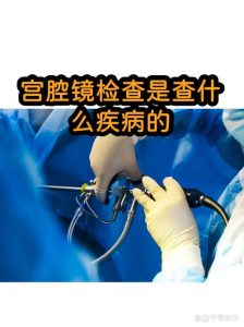痛经查不出原因,到底要不要做宫腔镜?-两性知识丨两性健康--你想了解的我都知道
