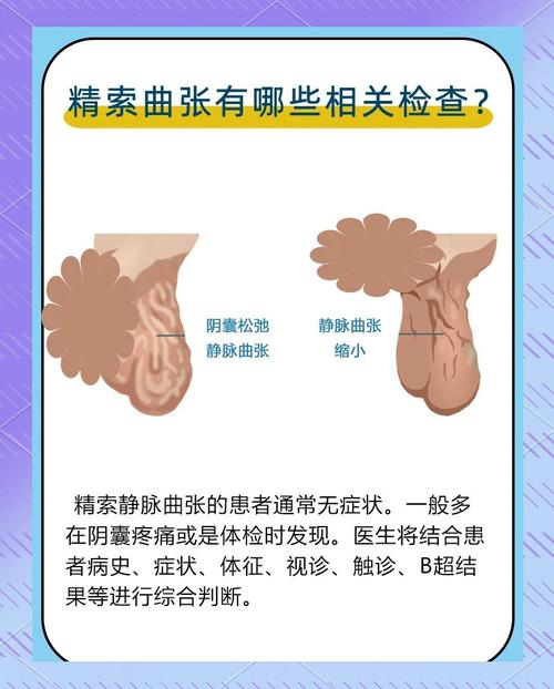 精索静脉曲张与碎片率有关吗