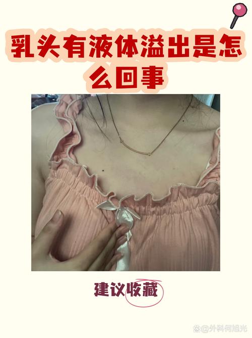 乳头溢液什么情况要就诊