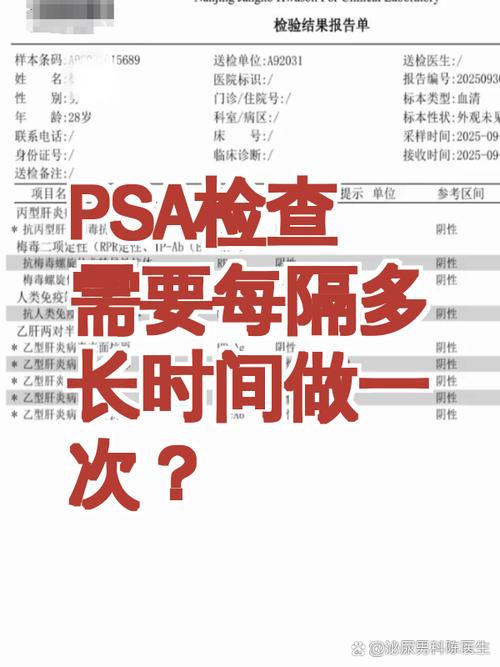 有家族史的人该多久查一次PSA