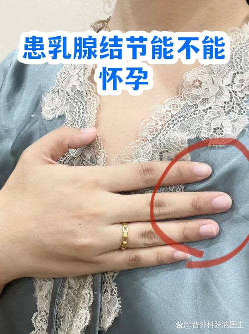 乳腺结节影响怀孕吗