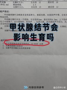 甲状腺结节会影响怀孕和生育吗？一文讲清备孕必看要点📝-两性知识丨两性健康--你想了解的我都知道